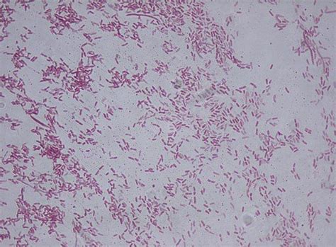 What is Pseudomonas Bacteria? Characteristics, Gram stain & Infection ...