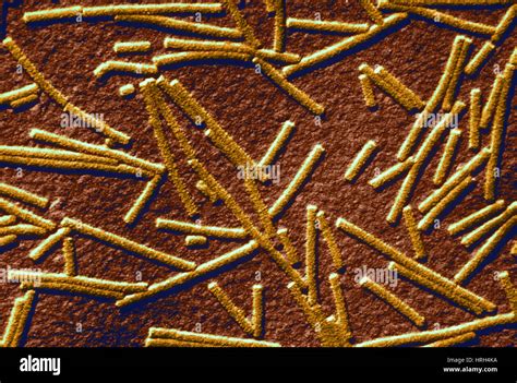 Tobacco mosaic virus Stock Photo - Alamy