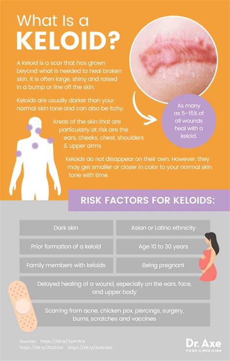 Keloid Causes (Plus, 5 Natural Tips to Help Treat Keloids) - Dr. Axe