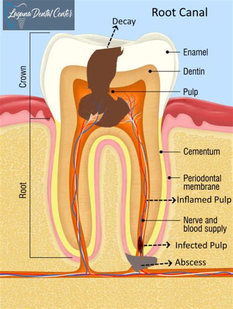 The Dental Cavity Procedure: Just How To Turn Around The Procedure And Also Prevent A Tooth Cavity