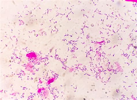 Premium Photo | Gram staining is a method of differentiating between Gram positive and Gram ...