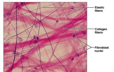 Chapter 2 Histology Connective Tissue Pictures Flashcards | Quizlet