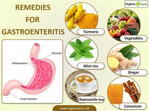 gastroenteritisinfo | Gastroenteritis, Gastro, Remedies