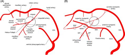 External Carotid Artery Branches