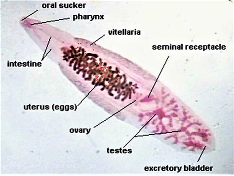 Clonorchiasis, clonorchis sinensis infection symptoms, diagnosis & treatment