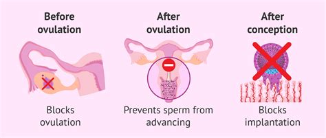 Morning-after pill: what are its effects and cost?