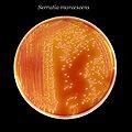 Category:Serratia marcescens - Wikimedia Commons