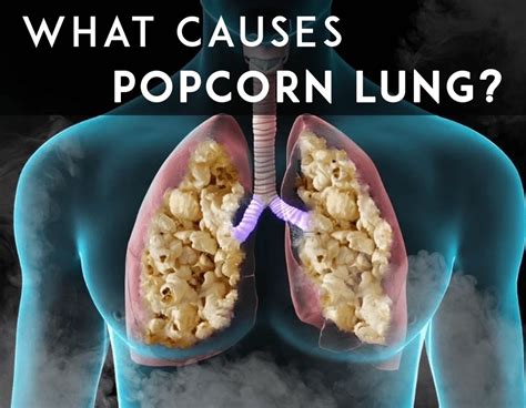 The Truth about Popcorn Lung: Debunking Myths and Misconceptions | Vape ...