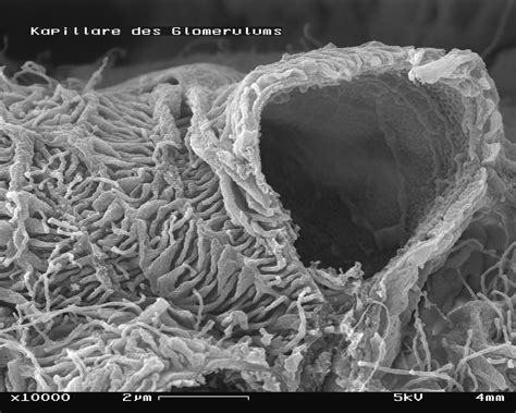 File:Glomerulum of mouse kidney with broken capillary in Scanning Electron Microscope ...