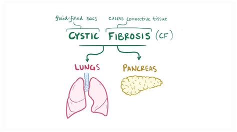 Cystic fibrosis: Video, Anatomy, Definition & Function | Osmosis