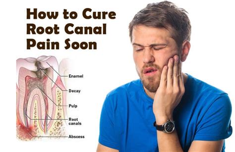 15 Easy Home Remedies To Cure Root Canal Pain Fast That Work