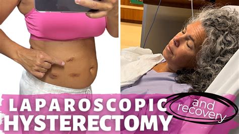 My Laparoscopic Hysterectomy Story & Recovery | Surgical Menopause What to Expect - YouTube