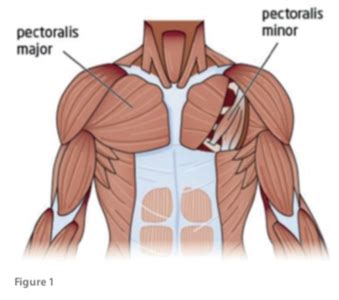 Pectoralis Major Strain - Sports Clinic NQ