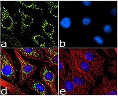 Recombinant Rabbit Monoclonal Antibodies - Creative Diagnostics