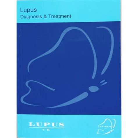 Lupus Diagnosis And Treatment | Konga Online Shopping