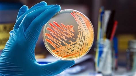 Microbiology Testing Services | DLSLAB.com