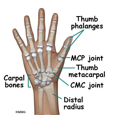 eOrthopod Patient Education