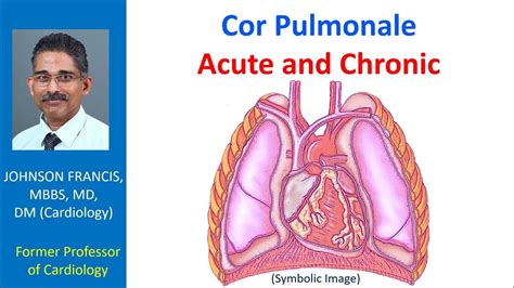 Cor Pulmonale: Acute and Chronic - YouTube