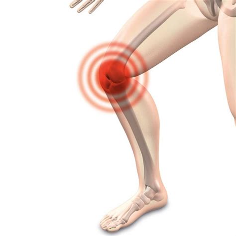 Scientists uncover why knee joint injury lead | EurekAlert!