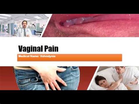 Vulvodynia (Vaginal Pain) : Causes, Diagnosis, Symptoms, Treatment ...