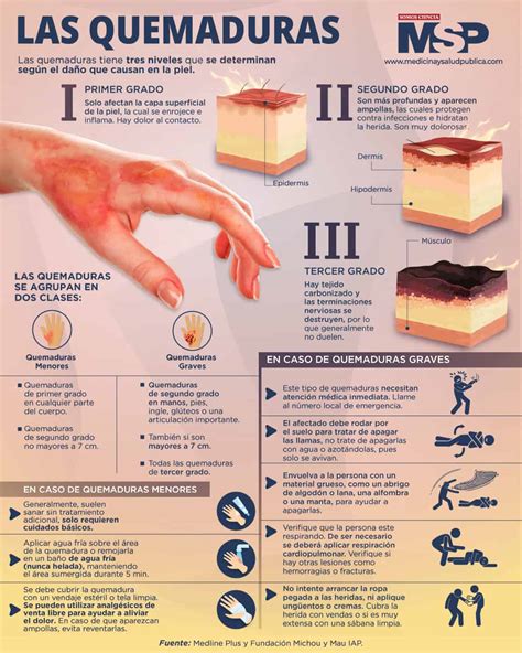 Tratamiento De Lesiones Por Quemaduras De Piel Primeros Auxilios Para ...