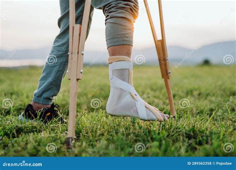 Close Up of Broken Ankle in Plaster Cast. Stock Photo - Image of pain ...