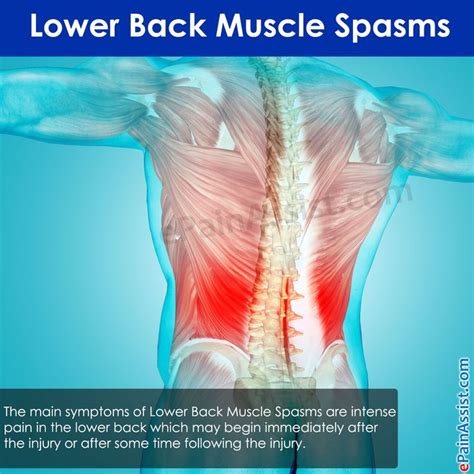 142 best Back Pain images on Pinterest | Back pain, Degenerative disc disease and Facts