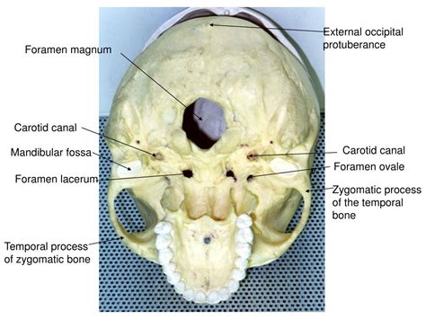 PPT - Incisive foramen PowerPoint Presentation, free download - ID:6875522