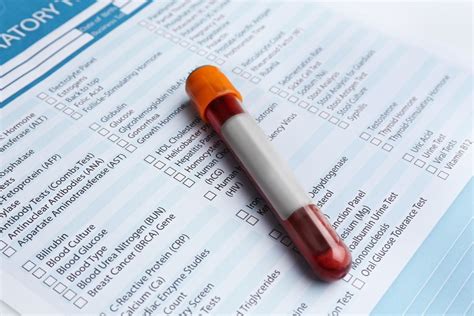 Top 10 Blood Tests for Older Adults: What to Know