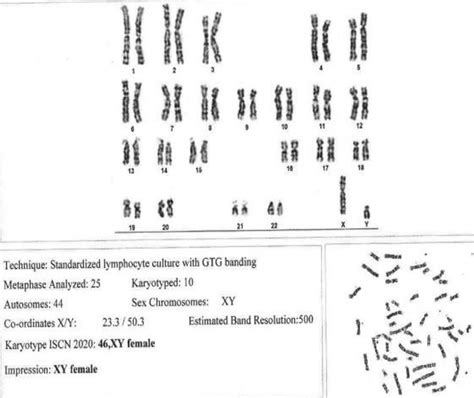 -Cytogenetic analysis showing a 46-XY karyotype. | Download Scientific Diagram