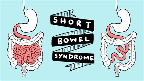 better health short gut syndrome - Madeleine Metcalfe