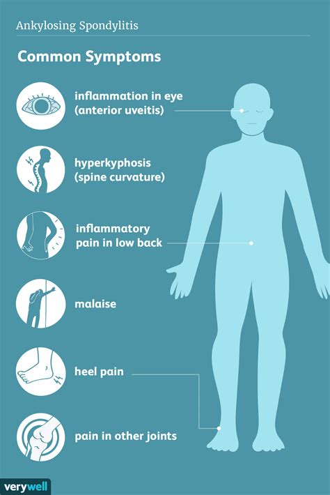 Symptoms of ankylosis spondylitis