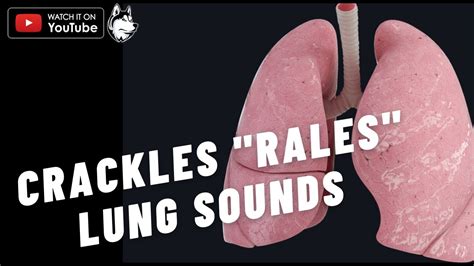 Abnormal Lung Sounds - Fine crackles, Coarse crackles, Rales - Lung sounds - YouTube