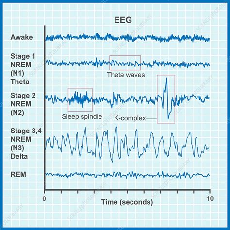 EEG sleep stages, illustration - Stock Image - C051/0074 - Science Photo Library