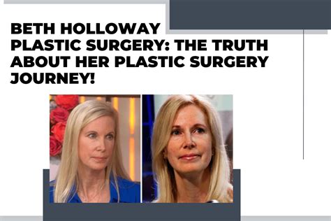 Beth Holloway Plastic Surgery: The Truth About Her Plastic Surgery Journey!