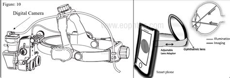 binocular indirect ophthalmoscopy tutorial - whitemickeymousevans