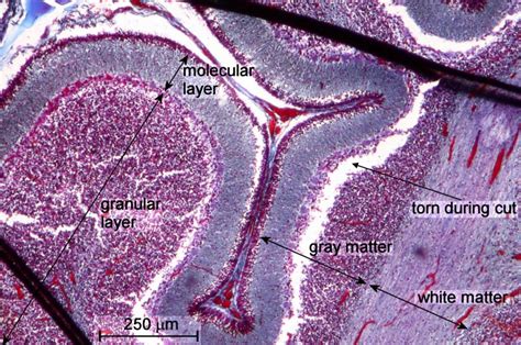 Human Brain Tissue