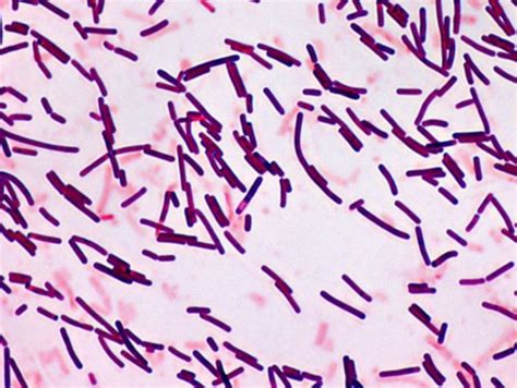 microbiology - Are acid-fast bacteria Gram-positive or Gram-negative? - Biology Stack Exchange