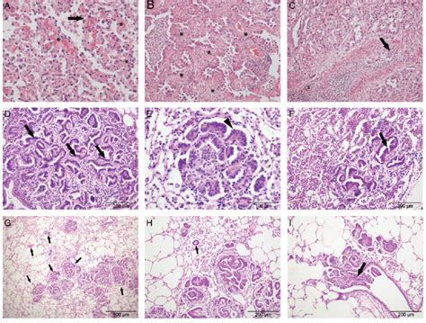 Histological appearance of human lung adenocarcinoma and OPA ...