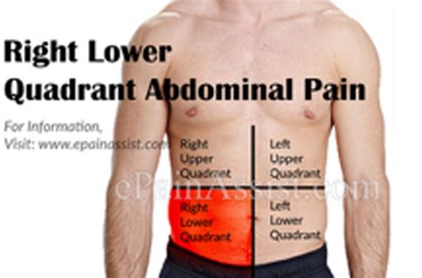 Right Abdominal Pain