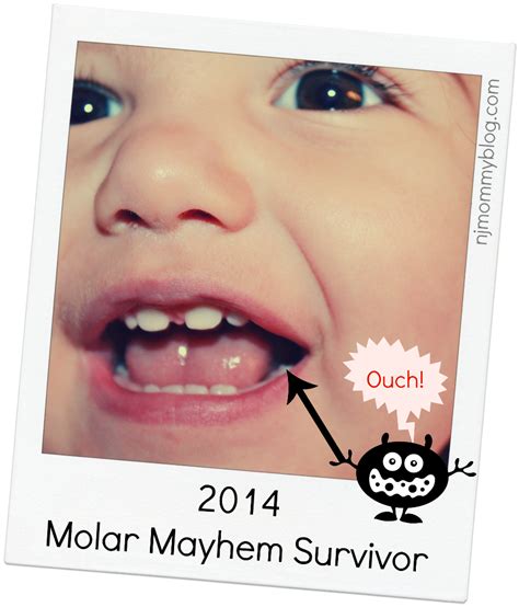 Toddler Teething: Signs and Symptoms of the First Molars | Teething toddler, Teething signs ...