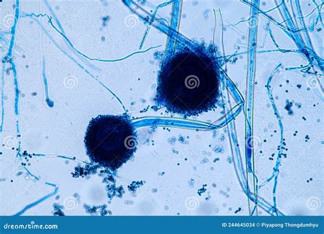 Aspergillus Niger And Aspergillus Oryzae Mold Under Microscope. Stock Photography ...