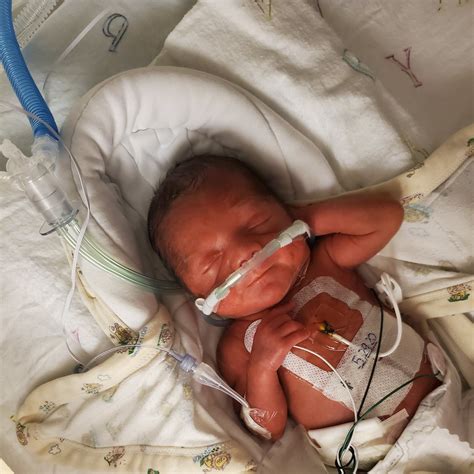 Foundation helps parents of preemie babies | The Long Island Advance