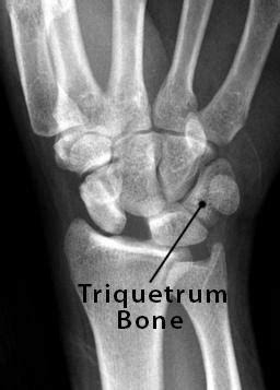 Triquetrum Bone Location, Anatomy, Function, & Diagram