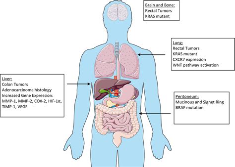 Surgical Treatment of Metastatic Colorectal Cancer - Surgical Oncology Clinics