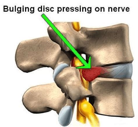 How To Deal With Back Pain | Seva Physiotherapy | Seva Physiotherapy