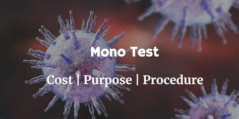 Is Mono an STD? What is Mono Test Cost? And much more about Mono ...