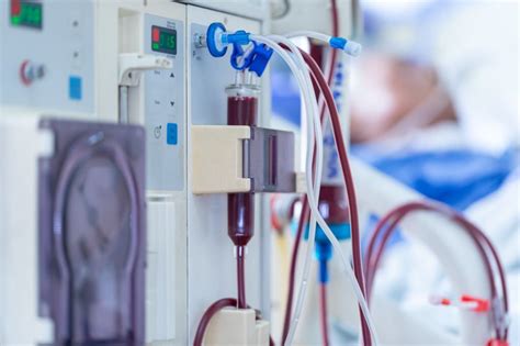 Kidney Dialysis Center (Hospital) | Dialysis Cost in Bangalore