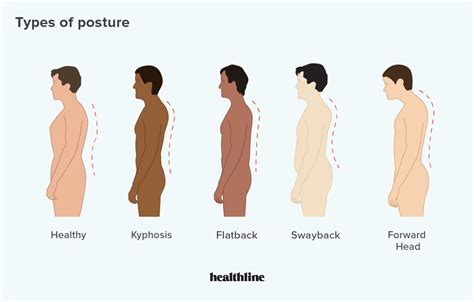 Types of Posture: How to Correct Bad Posture Posture Brace, Proper Posture, Bad Posture, Better ...