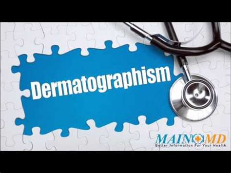 Dermatographism ¦ Treatment and Symptoms - YouTube